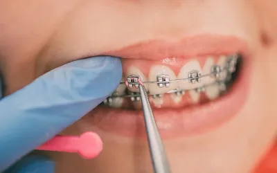 Ortodoncia dental